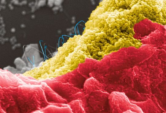 Bakterienzellen (rot) auf einem programmierbaren Kompositmaterial aus Silica-Nanopartikeln (gelb) und Kohlenstoff-Nanoröhren (blau) Bakterienzellen (rot) auf einem programmierbaren Kompositmaterial aus Silica-Nanopartikeln (gelb) und Kohlenstoff-Nanoröhren (blau)