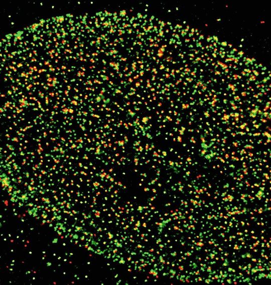 Ohne das Signal zur Enthüllung ihrer DNA werden die Adenoviren (rot) an den Kernporen-Strukturen der menschlichen Zelle (grün) gestoppt. Ohne das Signal zur Enthüllung ihrer DNA werden die Adenoviren (rot) an den Kernporen-Strukturen der menschlichen Zelle (grün) gestoppt.