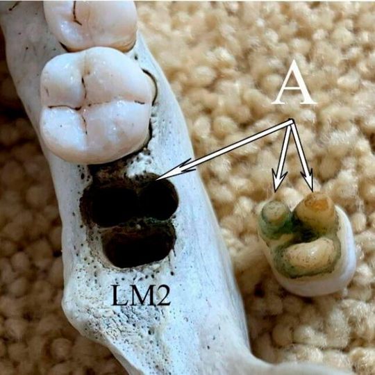 A study refutes the similarities between the teeth of Denisovans and modern Asians. A study refutes the similarities between the teeth of Denisovans and modern Asians.