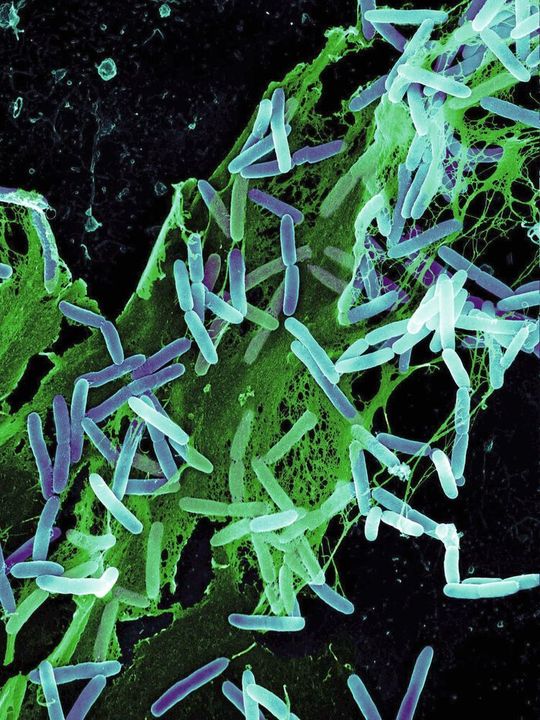 Pseudomonas aeruginosa gehört zu den so genannte opportunistischen Krankheitserregern Pseudomonas aeruginosa gehört zu den so genannte opportunistischen Krankheitserregern