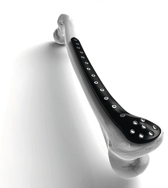 Metallfreies distales Femurplattenmodell aus dem Compositewerkstoff Peek-Optima Ultra-Reinforced von Invibio (die gezeigte Traumaplatte steht nicht zur Distribution oder Implantation zur Verfügung). Metallfreies distales Femurplattenmodell aus dem Compositewerkstoff Peek-Optima Ultra-Reinforced von Invibio (die gezeigte Traumaplatte steht nicht zur Distribution oder Implantation zur Verfügung).