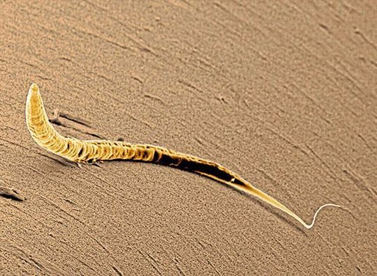 Die erste Zellteilung des Fadenwurms C. elegans wird durch ein PAR-Protein Muster reguliert. Die erste Zellteilung des Fadenwurms C. elegans wird durch ein PAR-Protein Muster reguliert.