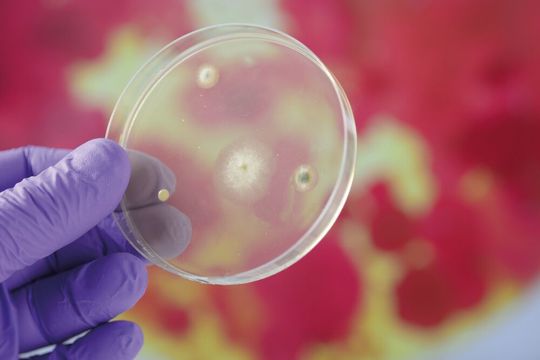 Klassische Analysenmethoden auf Antibiotikaresistenzen basieren auf mikrobiologischen Zellkulturen. Ein Nachteil ist, das diese recht zeitaufwändig sind. Klassische Analysenmethoden auf Antibiotikaresistenzen basieren auf mikrobiologischen Zellkulturen. Ein Nachteil ist, das diese recht zeitaufwändig sind.