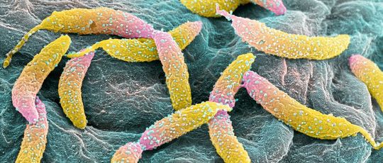 Das Signalmolekül c-di-GMP steuert Zellteilung bei Caulobacter crescentus. Das Signalmolekül c-di-GMP steuert Zellteilung bei Caulobacter crescentus.
