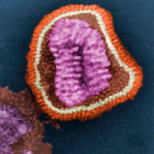 This digitally-colorized transmission electron microscopic image depicts the ultrastructural details of an influenza virus particle. This digitally-colorized transmission electron microscopic image depicts the ultrastructural details of an influenza virus particle.
