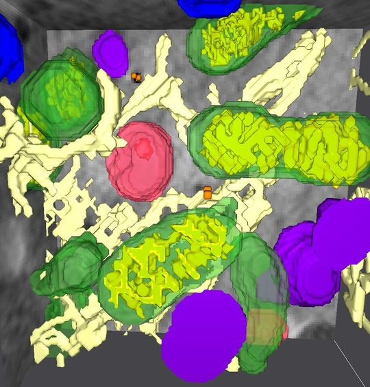 Kombination der einzelnen Aufnahmen zu einem 3D-Bild der Zellarchitektur mit Mitochondrien (grün), Lysosomen (lila), multivesikulären Körperchen (rot) und dem endoplasmatischen Retikulum (beige). Kombination der einzelnen Aufnahmen zu einem 3D-Bild der Zellarchitektur mit Mitochondrien (grün), Lysosomen (lila), multivesikulären Körperchen (rot) und dem endoplasmatischen Retikulum (beige).