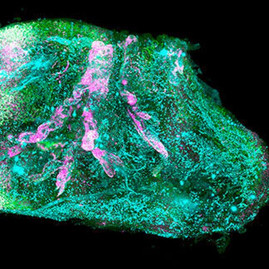 Vascular and glomeruli details of the human kidney. Vascular and glomeruli details of the human kidney.