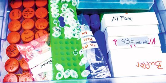 Abb. 1: Handbeschriftete Proben sind nicht nur schwer wiederzufinden, sondern können auch unnötige Kosten verursachen. Abb. 1: Handbeschriftete Proben sind nicht nur schwer wiederzufinden, sondern können auch unnötige Kosten verursachen.