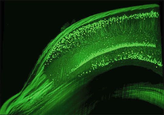Querschnitt durch den Hippocampus einer Maus. Nach der Gabe von Erythropoietin weisen die Tiere mehr Nervenzellen in dieser für Lernen und Gedächtnis zentralen Gehirnregion auf. Querschnitt durch den Hippocampus einer Maus. Nach der Gabe von Erythropoietin weisen die Tiere mehr Nervenzellen in dieser für Lernen und Gedächtnis zentralen Gehirnregion auf.