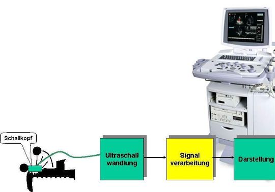 Bild 1: Prinzip des sonografischen Vorgangs Bild 1: Prinzip des sonografischen Vorgangs