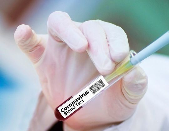 Österreichische Forscher haben eine High-Speed-Technologie im Kampf gegen Covid-19 entwickelt. Österreichische Forscher haben eine High-Speed-Technologie im Kampf gegen Covid-19 entwickelt.