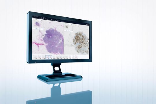The digital pathology solution is a component of Sectra’s enterprise imaging offering. The digital pathology solution is a component of Sectra’s enterprise imaging offering.