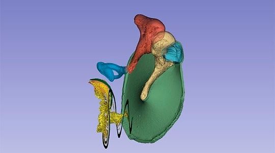 Three-dimensional image of the inner ear: The eardrum (green) and the auditory bones the malleus (light yellow), the incus (orange) and the stapes (blue). Three-dimensional image of the inner ear: The eardrum (green) and the auditory bones the malleus (light yellow), the incus (orange) and the stapes (blue).