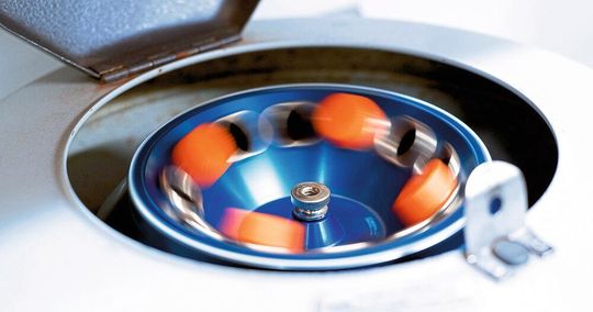 L'automatisation arrive aussi dans les laboratoires notamment grâce à l'intégration des minimoteurs Faulhaber dans les installations de diagnostic. L'automatisation arrive aussi dans les laboratoires notamment grâce à l'intégration des minimoteurs Faulhaber dans les installations de diagnostic.