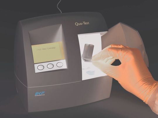 EKF’s Quo-Test fully automated desktop HbA1c analyzer provides easy and reliable HbA1c measurement for monitoring and managing diabetes in a Point-of-Care setting. EKF’s Quo-Test fully automated desktop HbA1c analyzer provides easy and reliable HbA1c measurement for monitoring and managing diabetes in a Point-of-Care setting.