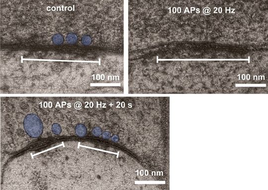 Foto eines möglichen Engramms: Ohne Aktivität befinden sich nur wenige Vesikel an der Synapse. Nach einem kurzen Aktivitätsausbruch docken Vesikel an der Synapse an. Der Pool der Vesikel ist noch Minuten später an der Synapse gespeichert. Dieser Pool könnte eine physische Spur des Gedächtnisses sein, ein so genanntes Engramm. Foto eines möglichen Engramms: Ohne Aktivität befinden sich nur wenige Vesikel an der Synapse. Nach einem kurzen Aktivitätsausbruch docken Vesikel an der Synapse an. Der Pool der Vesikel ist noch Minuten später an der Synapse gespeichert. Dieser Pool könnte eine physische Spur des Gedächtnisses sein, ein so genanntes Engramm.