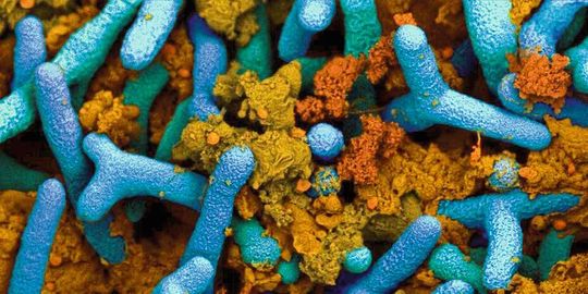 Knöllchenbakterien (blau) in einer Pflanzenwurzel. Braun sichtbar sind pflanzliche Proteine (kolorierte elektronenmikroskopische Aufnahme). Knöllchenbakterien (blau) in einer Pflanzenwurzel. Braun sichtbar sind pflanzliche Proteine (kolorierte elektronenmikroskopische Aufnahme).