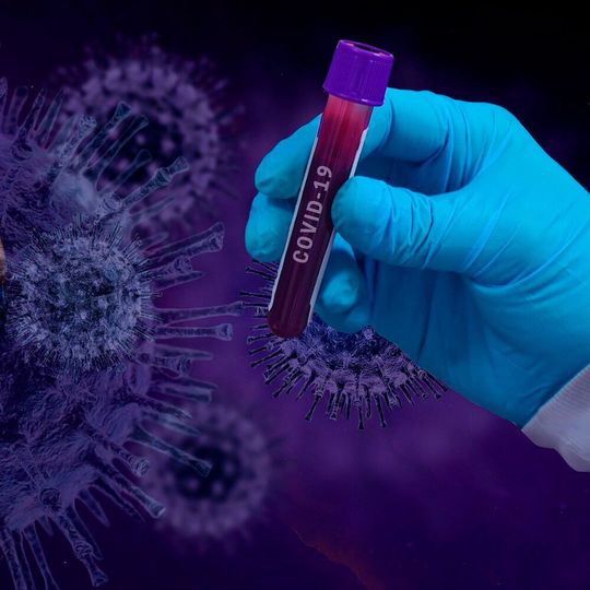 Um schnell einen geeigneten Wirkstoff gegen das Coronavirus Sars-Cov-2 zu finden, testen akademische Einrichtungen weltweit an Zellkulturen die Wirksamkeit zugelassener Arzneimittel. Um schnell einen geeigneten Wirkstoff gegen das Coronavirus Sars-Cov-2 zu finden, testen akademische Einrichtungen weltweit an Zellkulturen die Wirksamkeit zugelassener Arzneimittel.