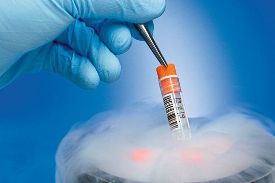 Etiketten für kryogene Anwendungen Etiketten für kryogene Anwendungen