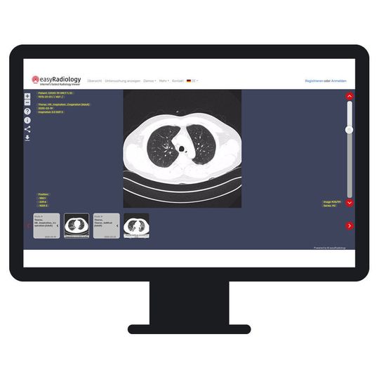 Bilder und Befunde werden via Internet an Patienten und weiterbehandelnde Ärzte versendet, die Röntgenaufnahmen können auf Smartphone, Tablet oder Laptop ohne Installation von Software betrachtet werden. Bilder und Befunde werden via Internet an Patienten und weiterbehandelnde Ärzte versendet, die Röntgenaufnahmen können auf Smartphone, Tablet oder Laptop ohne Installation von Software betrachtet werden.