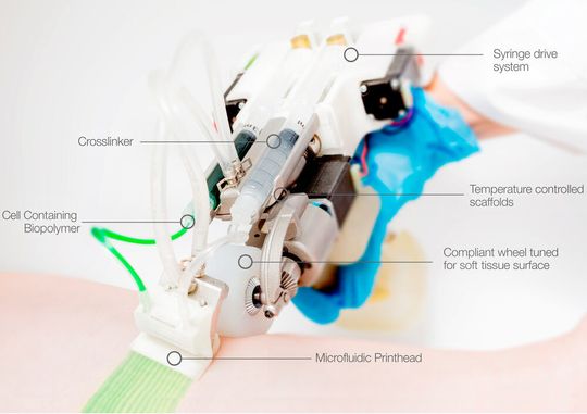 Der Gesamtsieger der 3D Pioneer Challenge 2020 ist der „Rever Tome Handheld Bioprinter“ der Universität Toronto. Das Projekt von Richard Cheng, Gertraud Eylert, Jean-Michel Gariepy, Sijin He, Yizhou Gao, Hasan Ahmad, Marc Jeschke und Axel Guenther ist ein mobiles chirurgisches Instrument, das Hautschichten bei großen Verbrennungen gleichmäßig abgibt, um die Wundheilung zu verbessern. Das Team um Richard Cheng wurde mit dem Preisgeld in Höhe von 10.000 € prämiert. Der Gesamtsieger der 3D Pioneer Challenge 2020 ist der „Rever Tome Handheld Bioprinter“ der Universität Toronto. Das Projekt von Richard Cheng, Gertraud Eylert, Jean-Michel Gariepy, Sijin He, Yizhou Gao, Hasan Ahmad, Marc Jeschke und Axel Guenther ist ein mobiles chirurgisches Instrument, das Hautschichten bei großen Verbrennungen gleichmäßig abgibt, um die Wundheilung zu verbessern. Das Team um Richard Cheng wurde mit dem Preisgeld in Höhe von 10.000 € prämiert.