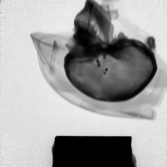 Sturzversuch eines Fahrradhelms mit künstlichem Schädel. Der Aufschlag lässt sich mittels Röntgentechnik in Zeitlupe verfolgen. Zwischen beiden Bildern liegen rund 11 Millisekunden.