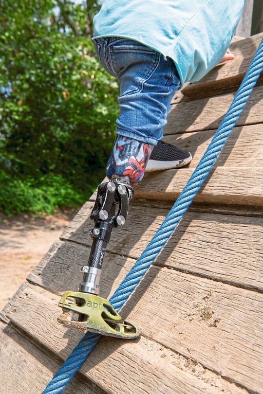 Der Prothesenfuß Firstep von Mecuris ermöglicht individuelle Gestaltungsmöglichkeiten und seinen Trägern die volle Bewegungsfreiheit. Der Prothesenfuß Firstep von Mecuris ermöglicht individuelle Gestaltungsmöglichkeiten und seinen Trägern die volle Bewegungsfreiheit.
