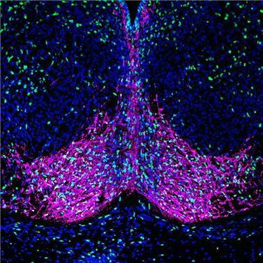 The magenta staining shows brain cells that release dopamine. The green staining shows newly generated cells. The blue staining shows all cells. The magenta staining shows brain cells that release dopamine. The green staining shows newly generated cells. The blue staining shows all cells.
