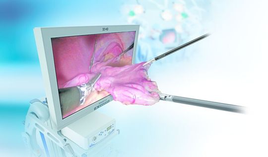Hightech-Medizintechnologien werden nach Ansicht des Bundesverbandes Medizintechnologie, BV-Med, im aktuellen Entwurf des Krankenhaus-Zukunftsgesetzes (KHZG) zu wenig berücksichtigt. Hightech-Medizintechnologien werden nach Ansicht des Bundesverbandes Medizintechnologie, BV-Med, im aktuellen Entwurf des Krankenhaus-Zukunftsgesetzes (KHZG) zu wenig berücksichtigt.