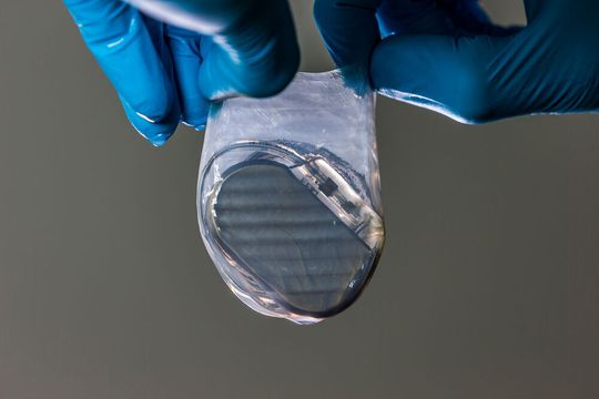 Das Start-up Hylomorph ist eines von zehn Finalisten des diesjährigen Heraeus Accelerator. Das Unternehmen hat eine chirurgische Membran entwickelt, die die Schnittstelle zwischen Implantaten und menschlichem Gewebe optimiert. Das Start-up Hylomorph ist eines von zehn Finalisten des diesjährigen Heraeus Accelerator. Das Unternehmen hat eine chirurgische Membran entwickelt, die die Schnittstelle zwischen Implantaten und menschlichem Gewebe optimiert.