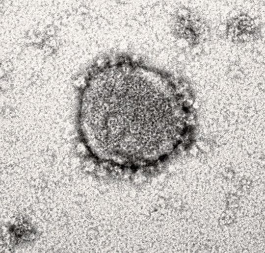 Das neue Coronavirus steht im Zentrum zahlreicher Forschungsprojekte des Ulmer Instituts für Molekulare Virologie. Jetzt haben die Forschenden einen vielversprechenden zelleigenen und antiviralen Faktor charakterisiert Das neue Coronavirus steht im Zentrum zahlreicher Forschungsprojekte des Ulmer Instituts für Molekulare Virologie. Jetzt haben die Forschenden einen vielversprechenden zelleigenen und antiviralen Faktor charakterisiert