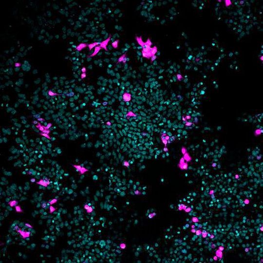 Cells cultured in the laboratory (cyan). Artificial viruses that mimic Sars-Cov-2 (magenta) infect the cells via Ace2 and neuropilin-1. Cells cultured in the laboratory (cyan). Artificial viruses that mimic Sars-Cov-2 (magenta) infect the cells via Ace2 and neuropilin-1.