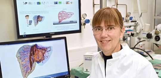 Die von Prof. Dr. Uta Dahmen koordinierte Forschungsgruppe will Durchblutung und Funktion der Leber mit großer räumlicher Auflösung in gesundem und krankem Zustand modellieren. Die von Prof. Dr. Uta Dahmen koordinierte Forschungsgruppe will Durchblutung und Funktion der Leber mit großer räumlicher Auflösung in gesundem und krankem Zustand modellieren.