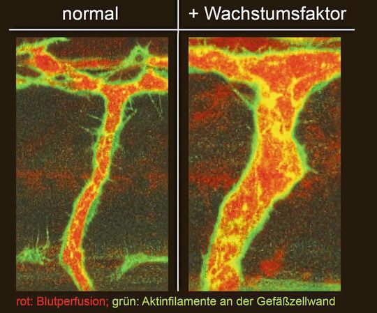 Darstellung natürlich wachsender lebender Arterien und fluoreszenzmikroskopische Darstellung des Blutflusses und des endothelialen Aktin Zytoskeletts. Darstellung natürlich wachsender lebender Arterien und fluoreszenzmikroskopische Darstellung des Blutflusses und des endothelialen Aktin Zytoskeletts.