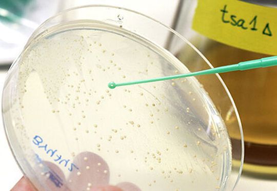 Yeast can be grown on both solid and liquid nutrition medium and is a good model system for studying ageing. Yeast can be grown on both solid and liquid nutrition medium and is a good model system for studying ageing.