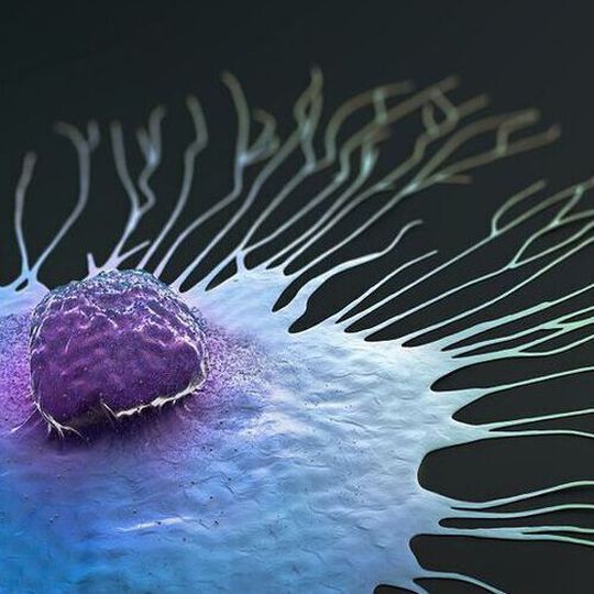 The study involved analysing the tissue and treatment history of almost 13,000 patients. The study involved analysing the tissue and treatment history of almost 13,000 patients.