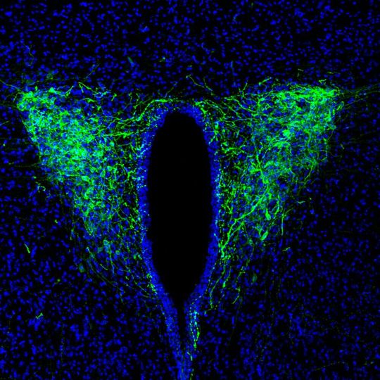 The optogenetic tool "Channelrhodopsin2" expresses CRF neurons in the paraventricular nucleus of the hypothalamus in mice. These neurons were found to be part of the neural pathway that is crucial for the circadian regulation of sleep and wakefulness. The optogenetic tool "Channelrhodopsin2" expresses CRF neurons in the paraventricular nucleus of the hypothalamus in mice. These neurons were found to be part of the neural pathway that is crucial for the circadian regulation of sleep and wakefulness.
