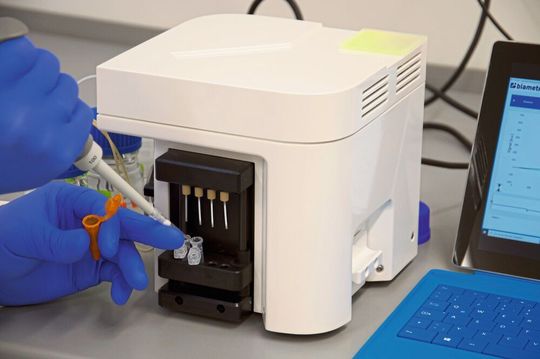 „bportable“ ist ein Prototyp für ein Schnelltestgerät „bportable“ ist ein Prototyp für ein Schnelltestgerät
