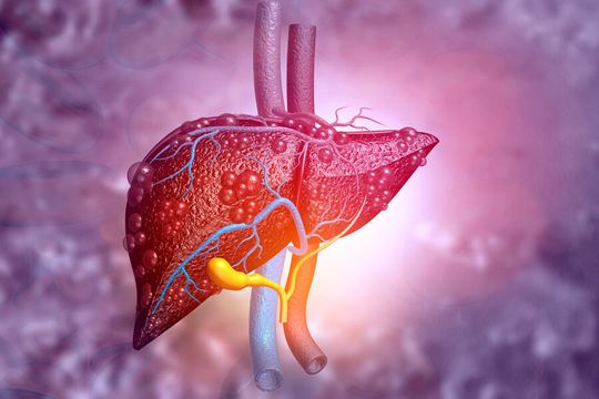 MIT engineers have developed a diagnostic tool, based on nuclear magnetic resonance (NMR), that can be used to detect fatty liver disease and liver fibrosis. MIT engineers have developed a diagnostic tool, based on nuclear magnetic resonance (NMR), that can be used to detect fatty liver disease and liver fibrosis.