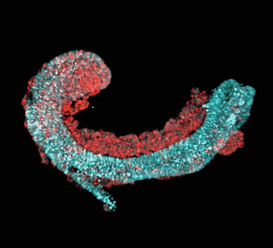 Fluoreszenz-mikroskopische Aufnahme einer „trunk-like structure“, die dem Rumpf eines Mausembryos ähnelt und in einer aufwändigen Zellkultur erzeugt wurde. Sie ist aus embryonalen Stammzellen einer Maus herangewachsen und weist typische Merkmale der frühen Wirbeltierentwicklung auf, wie die Segmentierung des Somiten-Gewebes, der Grundlage von Knochen, Muskeln und Knorpeln (rot), und ein Neuralrohr, aus dem sich später das Rückenmark bilden würde (hellblau). Fluoreszenz-mikroskopische Aufnahme einer „trunk-like structure“, die dem Rumpf eines Mausembryos ähnelt und in einer aufwändigen Zellkultur erzeugt wurde. Sie ist aus embryonalen Stammzellen einer Maus herangewachsen und weist typische Merkmale der frühen Wirbeltierentwicklung auf, wie die Segmentierung des Somiten-Gewebes, der Grundlage von Knochen, Muskeln und Knorpeln (rot), und ein Neuralrohr, aus dem sich später das Rückenmark bilden würde (hellblau).