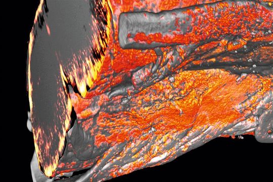 3D Lichtscheiben-Mikroskopie-Aufnahme: Werden Myelinscheiden im Rückenmark beschädigt, häufen sich Mikroglia und Makrophagen (orange) in diesen Problemzonen an, um das defekte Gewebe zu beseitigen. 3D Lichtscheiben-Mikroskopie-Aufnahme: Werden Myelinscheiden im Rückenmark beschädigt, häufen sich Mikroglia und Makrophagen (orange) in diesen Problemzonen an, um das defekte Gewebe zu beseitigen.