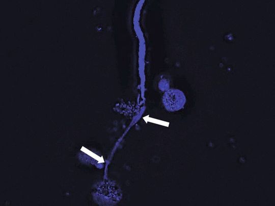 Eosinophile Granulozyten sind in der Lage, DNA-Netze auszuschütten und Mikrofilarien damit einzufangen. Die Fluoreszenzmikroskopieaufnahme zeigt, wie eine Mikrofilarie (oben) von den DNA-Netzen (blau angefärbt, Pfeile) der Eosinophilen Granulozyten (rundliche Strukturen) eingefangen wird. Eosinophile Granulozyten sind in der Lage, DNA-Netze auszuschütten und Mikrofilarien damit einzufangen. Die Fluoreszenzmikroskopieaufnahme zeigt, wie eine Mikrofilarie (oben) von den DNA-Netzen (blau angefärbt, Pfeile) der Eosinophilen Granulozyten (rundliche Strukturen) eingefangen wird.