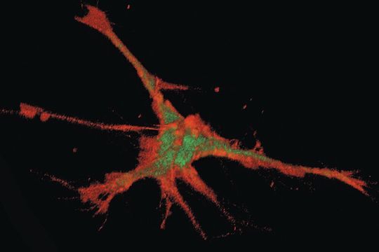 Magnetisch fanden die Nanopartikel ihren Weg in die Spitzen der Fortsätze von Nervenzellen. Magnetisch fanden die Nanopartikel ihren Weg in die Spitzen der Fortsätze von Nervenzellen.