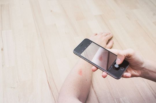 Das Start-up Onlinedoctor gilt als führender Anbieter der Teledermatologie in Europa. Fotos eines Hautproblems können samt einer kurzen Beschreibung hochgeladen werden und innerhalb von 48 Stunden gibt ein Dermatologe eine Handlungsempfehlung. Das Start-up Onlinedoctor gilt als führender Anbieter der Teledermatologie in Europa. Fotos eines Hautproblems können samt einer kurzen Beschreibung hochgeladen werden und innerhalb von 48 Stunden gibt ein Dermatologe eine Handlungsempfehlung.