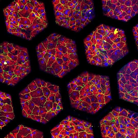 Eingefärbte Patientenzellen, die auf einer „Lunge auf Chip“ der zweiten Generation kultiviert wurden. Eingefärbte Patientenzellen, die auf einer „Lunge auf Chip“ der zweiten Generation kultiviert wurden.