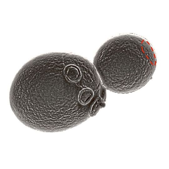Elektronenmikroskopische Aufnahme einer knospenden Hefezelle. Die rot gestrichelte Markierung auf der Knospe deutet die intrazelluläre Verteilung des Polarsioms an. Bei den „angenähten Knöpfen“ handelt es sich um Narben auf der Zellwand der Mutterzelle, an denen frühere Knospen bereits abgetrennt wurden. Elektronenmikroskopische Aufnahme einer knospenden Hefezelle. Die rot gestrichelte Markierung auf der Knospe deutet die intrazelluläre Verteilung des Polarsioms an. Bei den „angenähten Knöpfen“ handelt es sich um Narben auf der Zellwand der Mutterzelle, an denen frühere Knospen bereits abgetrennt wurden.