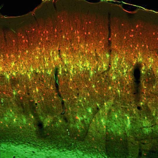 Im histologischen Hirnschnitt wurden Teile der extrazellulären Matrix (grün), die die Nervenzellen (rot) umgibt, angefärbt und unter dem Mikroskop analysiert. Im histologischen Hirnschnitt wurden Teile der extrazellulären Matrix (grün), die die Nervenzellen (rot) umgibt, angefärbt und unter dem Mikroskop analysiert.