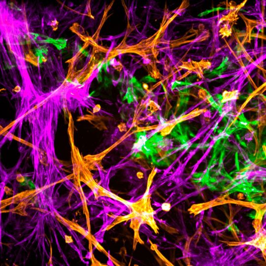 Neuron-D nutzt dreidimensionale Zellkulturen, um Wirkstoffkandidaten für die Behandlung neurodegenerativer Erkrankungen zu testen. Neuron-D nutzt dreidimensionale Zellkulturen, um Wirkstoffkandidaten für die Behandlung neurodegenerativer Erkrankungen zu testen.