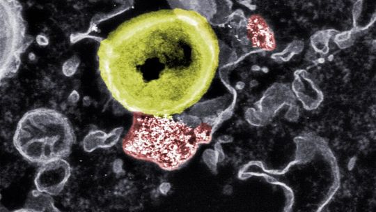 Tödlicher Kontakt: Forscher der Empa und der ETH Zürich haben Nanopartikel (rot) entwickelt, die resistente Bakterien (gelb) abtöten können. Tödlicher Kontakt: Forscher der Empa und der ETH Zürich haben Nanopartikel (rot) entwickelt, die resistente Bakterien (gelb) abtöten können.
