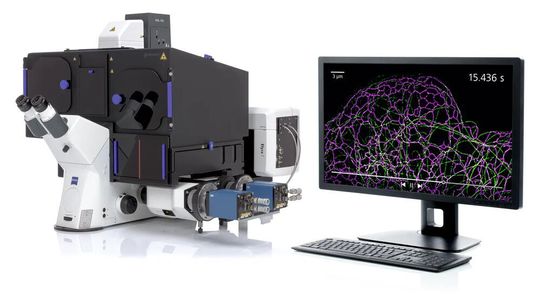 Mit dem SIM² Algorithmus zur Bildrekonstruktion kann auf dem Mikroskopsystem ZEISS Elyra 7 die herkömmliche SIM-Auflösung verdoppelt werden. Mit dem SIM² Algorithmus zur Bildrekonstruktion kann auf dem Mikroskopsystem ZEISS Elyra 7 die herkömmliche SIM-Auflösung verdoppelt werden.